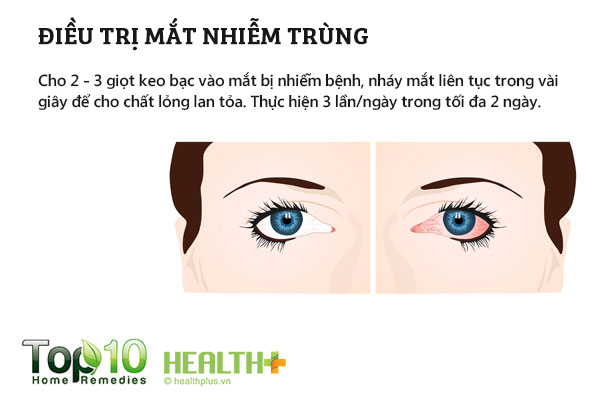 Cách dùng keo bạc để điều trị nhiễm trùng mắt