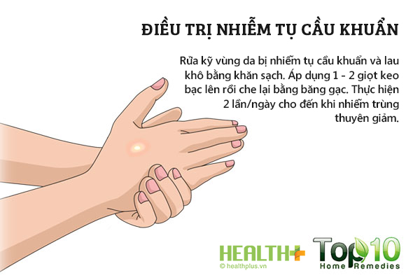 Cách dùng keo bạc điều trị nhiễm tụ cầu khuẩn