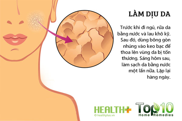 Cách dùng keo bạc để làm dịu da, làm lành vết thương, điều trị côn trùng đốt, vết mẩn đỏ